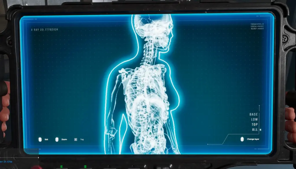 Todas as camadas no X-Ray
