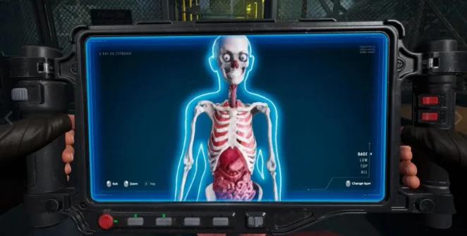 Imagem de raio-X do sobrevivente