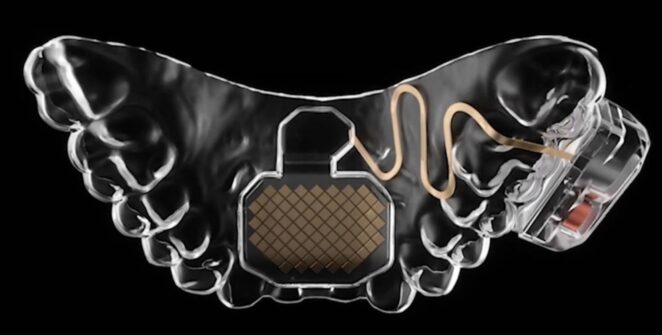 Mouth Pad: dispositivo controlado pela língua promete inclusão nos games e já está à venda nos EUA